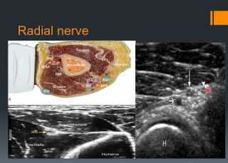 Elbow Ultrasound ENGLISH