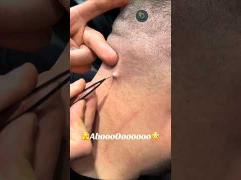 شاهد ماذا وجد هذا الحلاق تحت الجلد معلومات معلومات عامة حلاقة Shorts هل تعلم ثقافة Explore