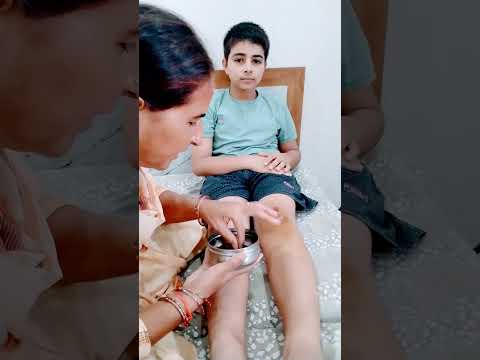 च ट क हल द और त ल क दव र घर पर उपच र क स कर