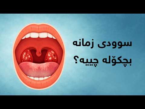 سوودی زمانە بچکۆلە چییە