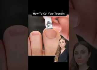 Never Get Another Ingrown Toenail With This Simple Fix Dermatologist