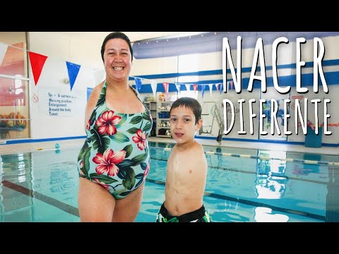 Nacimos Sin Brazos Somos Madre E Hijo Y Vivimos Al Máximo Nacimos Diferentes Nacimos Sin Brazos Somos Madre E Hijo Y Vivimos Al Máximo Nacimos Diferentes