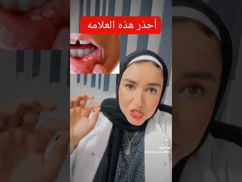 سبب من اسباب قرح الفم مصر Explore Exploremore