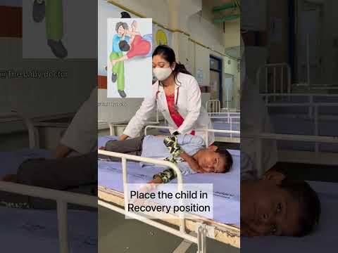 What To Do When A Child Develops Seizures Fits The Baby Doctor Seizures Shorts Fits Ytshorts What To Do When A Child Develops Seizures Fits The Baby Doctor Seizures Shorts Fits Ytshorts