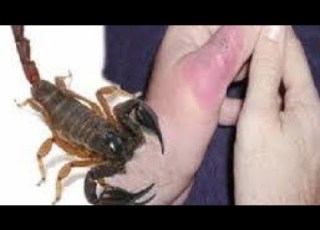 صحح معلوماتك الجزء الاولى سم العقرب