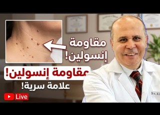  تخلص من الزوائد الجلدية بسرعة أفضل طريقة طبيعية وآمنة