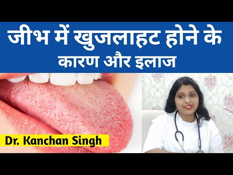 ज भ म ख जल हट ह न क क रण और इल ज Jibh Me Khujlahat Ka Ilaj Tongue Itching Treatment
