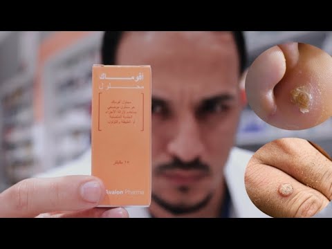 مزيل عيون السمكه والزوائد الجلدية مراجعه سريعه افوماك