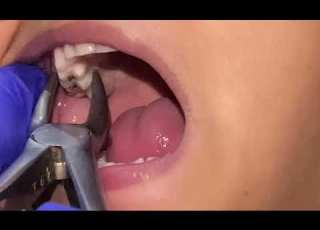  خلع ضرس للمبتدئين تطبيق عملي
