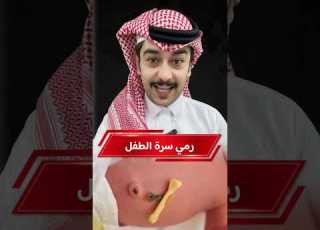  رمي سرة الطفل عند العرب وما علاقتها بمستقبل المولود وش تسوي سائد السردي