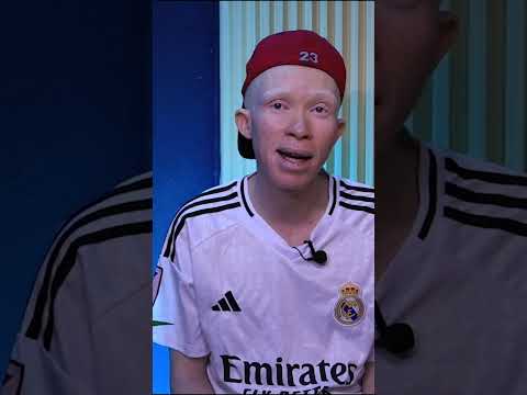 GERMAN BUNDESLIGA WEEKEND FIXTURES Football Germany Bayernmunchen Soccer 2025