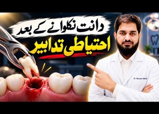  Care After Tooth Extraction دانت نکلوانے کے بعد احتیاط In Urdu Hindi Drmuneermalik32