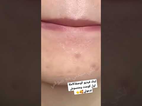 تبييض الوجه والبشرة للعيد خلال يوم فقط