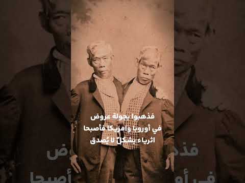 اشهر توأمين متلاصقين في التاريخ