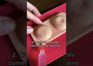 ABSCESS DRAINAGE