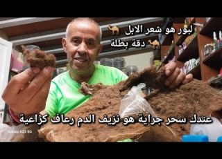  عندك سحر جراية هو نزيف الدم رعاف لوبر هو شعر الابل الجمال فك سحر الارحام الجن العاشق