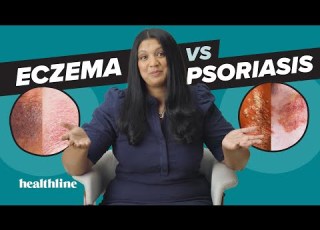  Ist Ihr Hautproblem PSORIASIS Oder EKZEM