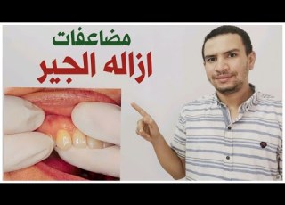  بعد ازاله الجير اصبحت اسناني تتحرك من مكانها