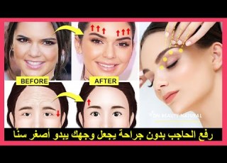 كيفية رفع الحاجب بدون جراحة