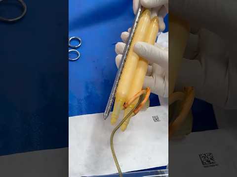 الدعامة الهيدروليكية زيادة الطول بالمقاسات قبل النفخ وبعده مباشرة من داخل غرفة العمليات دعامات الان الدعامة الهيدروليكية زيادة الطول بالمقاسات قبل النفخ وبعده مباشرة من داخل غرفة العمليات دعامات الان