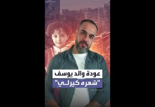 والد الطفل يوسف شعره كيرلي وأبيضاني الطبيب محمد أبو موسى يعود إلى مستشفى ناصر بخان يونس