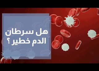  هل سرطان الدم خطير وهل يمكن الشفاء منه
