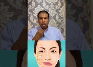 لو فيه الم خلف الاذن تفتكر ايه هو السبب دالنعمانى ابونار