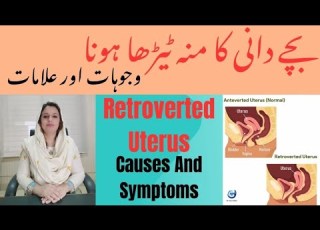 بچے دانی کا منہ ٹیڑھا ہونا وجوہات اور علامات Retroverted Uterus Causes And Symptoms Dr Sara Safdar