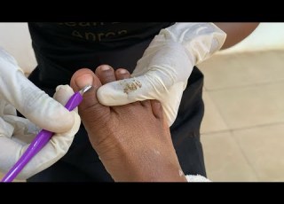 OMG SEE The Amount Of Dirt Pedicure Tutorial