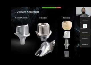  Hybrid Implant Design At Exocad For Dental Lab محاضرة ادم سلامة بعنوان