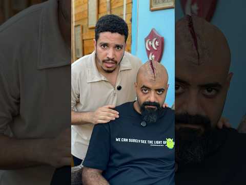 ازاي تعمل جرح سينمائي