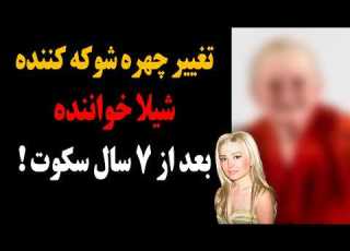  تغییر چهره شیلا خواننده بعد از هفت سال سکوت