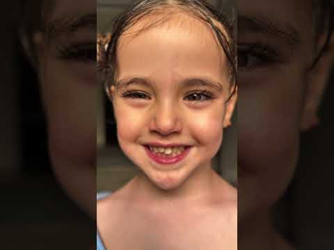 لما بنتك تكون حلوة ويصيبوها بالعين Twins Love Baby Viral