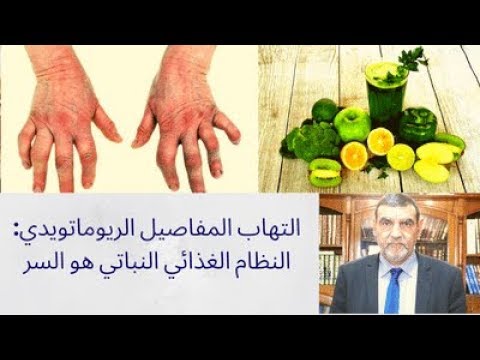 الدكتور محمد فائد التهاب المفاصيل الريوماتويدي النظام الغذائي النباتي هو السر