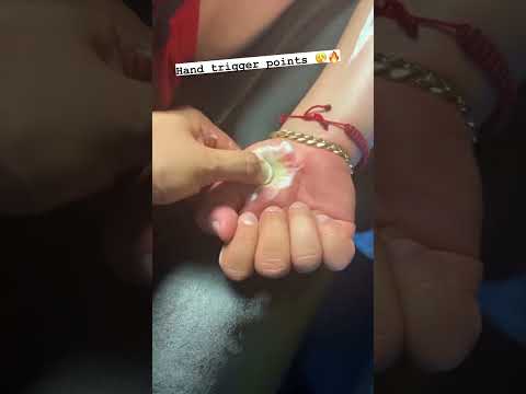 Do You Have Hand Or Thumb Pain This Is What YOU Need