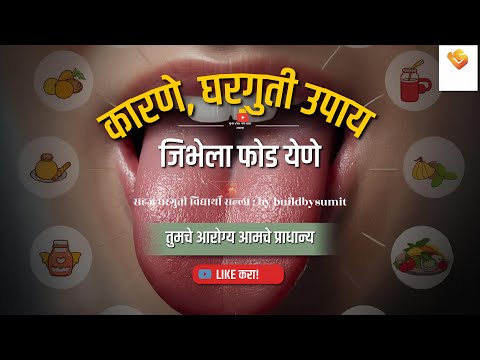 Jibhela Phod Yene Upay ज भ ल फ ड य ण घरग त उप य Jibhela Fod Yene Upay ज भ वर फ ड य ण उप य