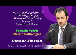 Female Pelvis Uterine Fibroid آموزش سونوگرافی التراساوند کتلات فیبرویید رحم