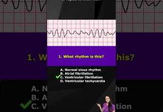 ECG Rhythm Pop Quiz Can You Identify These EKG Rhythms Shorts