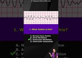 ECG Rhythm Pop Quiz Can You Identify These EKG Rhythms Shorts