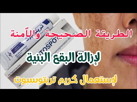 كريم تريتوسبوت الشهير الذي ٱثار ضجة كبيرة في اليوتيوب و الفايسبوك طريقة الإستعمال الصحيحة و الٱمنة