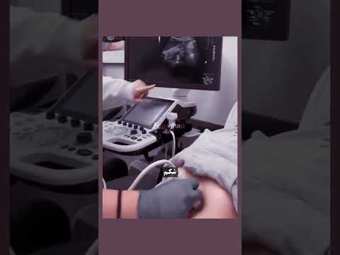 فک کن اینجوری بفهمی حامله ای