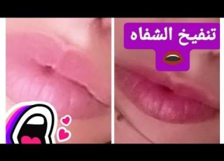 القرفة لتنفيخ و تقشير الشفاه نتيجة روعة و فورية