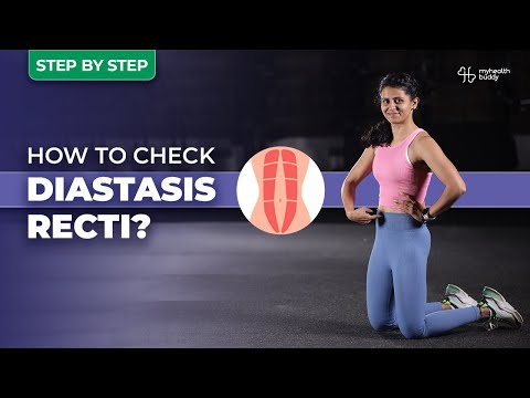 How To Check Diastasis Recti At Home