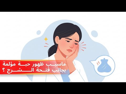 ما سبب ظهور حبة مؤلمة بجانب فتحة الشرج