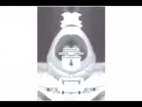 FIXED Klaskyklaskyklaskyklasky Gummy Bear In G Major 11