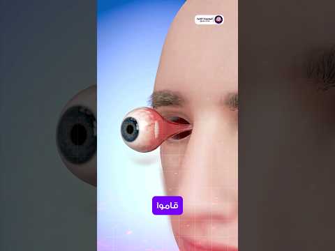 Eye Transplant Surgery