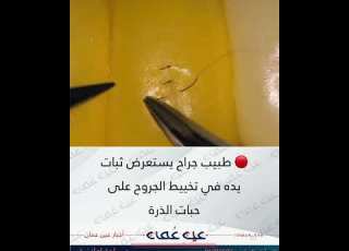  طبيب جراح يستعرض ثبات يده في تخييط الجروح على حبات الذرة