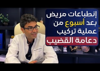  انطباعات مريض بعد اسبوع من تركيب دعامة مع الدكتور محسن بالابان