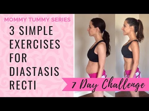 Get Rid Of Mommy Tummy With 3 Simple Diastasis Recti Exercises 7 Day Challenge