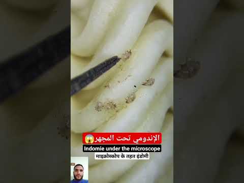 الإندومي تحت الميكرسكوب أو تحت المجهر أمراض الإندومي تحت الميكرسكوب أو تحت المجهر أمراض
